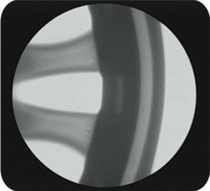 타이어 검사용 산업용 <span class=keywords><strong>NDT</strong></span> 시스템 디지털 X선 장비 - Product Image 6