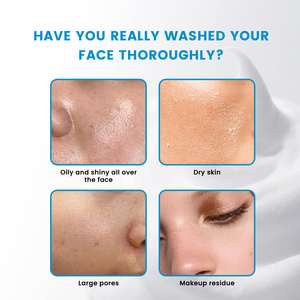 คลีนเซอร์หน้า PDRN กรดอะมิโน สูตรปรับแต่งได้สำห<span class=keywords><strong>รับ</strong></span>ขายส่ง - ปลอบประโลมและป<span class=keywords><strong>รับ</strong></span><span class=keywords><strong>ผิว</strong></span>ให้กระจ่างใสสำ<span class=keywords><strong>ห</strong></span><span class=keywords><strong>รับ</strong></span><span class=keywords><strong>ผิว</strong></span>ที่มีแนวโน้มเป็นสิว - Product Image 5