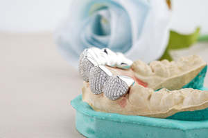 Juego de Grillz Personalizados de Plata con Incrustaciones de Diamantes de Moissanita Micro Pavé para los Dientes Inferiores, Estilo Hip Hop, para Hombres y Mujeres - Product Image 2