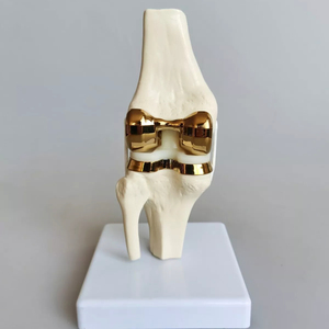 Modelo de prótesis de rodilla Artificial desmontable de calidad superior conjunto de modelo de implante de articulación de rodilla dorado pequeño único hecho en Pakistán - Product Image 2
