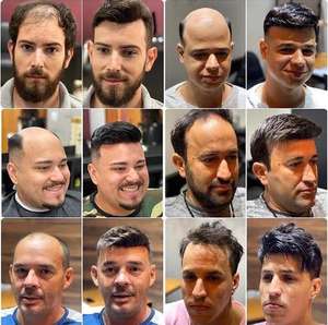 Haute qualité 100% vierge Remy indien dentelle fermeture cheveux patchs pour hommes droite soie Base prix de gros - Product Image 6