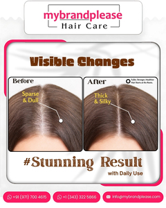 Huile de romarin pour cheveux et cuir chevelu Your Logo 100ml, revitalisant naturel pour la croissance des cheveux avec biotine et vitamine E - Product Image 2