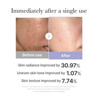 Medicube MINI Age-R Booster Pro - Fabriqué en Corée, soin de la peau coréen pour une peau de verre, anti-rides, beauté coréenne, cosmétiques coréens