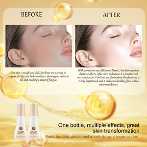 สารสกัดจากเปลือกไม้ Albizia julibrissin สำหรับใบหน้าสีทองสำหรับต่อต้านริ้วรอยบำรุงผิวเรียบเนียน - Product Image 6