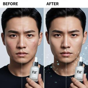 เซรั่ม OEM สำหรับรักษาสิว แอลกอฮอล์ล้างมือสำหรับรักษาสิว - Product Image 1