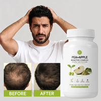 Complément capillaire à base de plantes, multivitamines, formule pour épaissir et réparer les cheveux, formule pour renforcer les cheveux, personnalisation prise en charge
