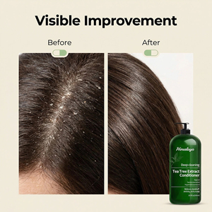 Acondicionador <span class=keywords><strong>de</strong></span> Árbol <span class=keywords><strong>de</strong></span> Té New <span class=keywords><strong>York</strong></span> Biology, Limpiador Profundo para la Caspa y el Cuero Cabelludo Seco y con Picazón - Product Image 4