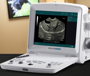 เครื่องอัลตราซาวนด์ดอปเปลอร์แบบพกพาขนาดกะทัดรัด EDAN DUS 60 - Product Image 3