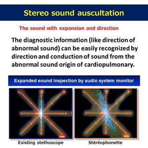 Estetoscopio Médico Manual Profesional Stereophonette No.171 YAMASU KENZMEDICO (Clase I con Certificación ISO y 1 Año de Garantía) - Product Image 3