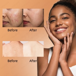 Bán Buôn Hữu Cơ Phi Đen Xà Phòng Cơ Thể Rửa Thành Phần Tự Nhiên Sâu Kem Dưỡng Ẩm - Product Image 4