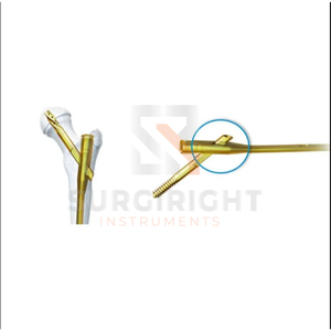 วัสดุไทเทเนียมออร์โทพีดิกส์ฝังเล็บภายในโดย surgiright - Product Image 2