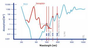 Láser de Diodo de 980nm para el Tratamiento de <span class=keywords><strong>Telangiectasias</strong></span> y Arañas Vasculares, Máquina de Eliminación Vascular - Product Image 5