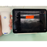 Escáner de Ultrasonido Inalámbrico Joymi 8L con Sonda Lineal, 7.5/10MHz, 192 Elementos, 64 Canales, para Uso Vascular, MSK, Nervios y Tiroides