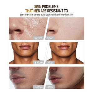 Ensemble de voyage pour hommes à la boue volcanique Nettoyant pour les pores Nettoyant pour le <span class=keywords><strong>visage</strong></span> Essence hydratante Lotion hydratante revitalisante pour <span class=keywords><strong>peau</strong></span> <span class=keywords><strong>grasse</strong></span> - Product Image 6