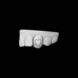 Grillz dentaire unique rose, design creux en forme de cœur, fait main, personnalisé, romantique, avec moissanite, plaqué or 14K, pour la Saint-Valentin - Product Image 2