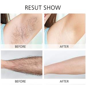 Cuchillas de Repuesto Flotantes 4D para Depiladoras Eléctricas de Mujer, Cabezales de Repuesto para Depilación en el Área del Bikini - Product Image 2