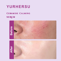 Sérum Visage OEM Marque Blanche Panthénol B5 et Céramide Hydratation Intense Contre les Rougeurs et Sensibilités Contrôle du Sébum Liquide