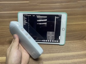 เครื่องตรวจอัลตราซาวนด์แบบใช้มือถืออุปกรณ์192อัลตร้าซาวด์ไร้สายแบบเส้นตรงสำหรับแพทย์ - Product Image 6