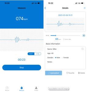 Stetoscopio Elettronico AI Portatile Mintti per Medici e Infermieri, Stetoscopio per Telemedicina - Product Image 5