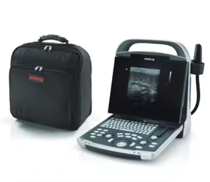 Mindray DP-30 Veterinaire Ultrasone Echografie Machine Digitale Ultrasone Diagnostische Beeldvormingssysteem Veterinaire Draagbare Echografie - Product Image 5