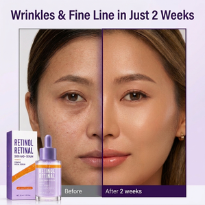 Suero Facial Hidratante de Alta Calidad con Vitamina C, 30 ml, Complejo Antigravedad - Product Image 3