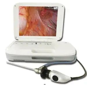 HD videoSIN-SED02 endoscopy system vagina video endoscope full hd vagina machine for Hospital internal medicine examination