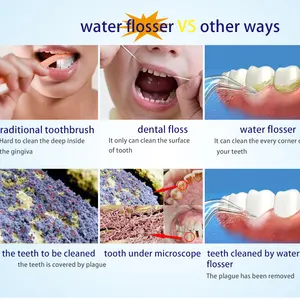 SINBOL Oral Irrigator Home Set Water Dental Flosser Dental Care Oral Irrigator For Teeth Whitening