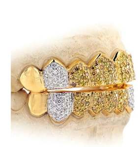 Custom Grillz <b>Frames</b> Gold with Fully Setting CZ Stones, Free Perm Cuts, Grillz Moissanite Diamonds, Silver 925, 10K 14K Gold - Product Image 3