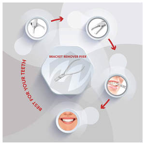 <b>Bracket</b> Remover Pliers Orthodontics Braces Removing Plier Dentistry 13cm <b>Bracket</b> Brace Remover Plier Professional Orthodontic - Product Image 3