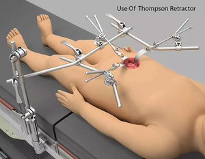Juego ortopédico profesional Thompson OEM ODM, kit de sistema de Retractor Quirúrgico, fabricante de retractores quirúrgicos personalizables - Product Image 2