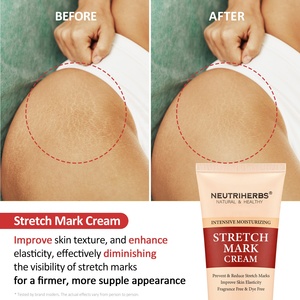 Etiqueta privada logotipo personalizado cuidado de la piel eliminar antiestrías embarazo <span class=keywords><strong>mejor</strong></span> crema para estrías - Product Image 3