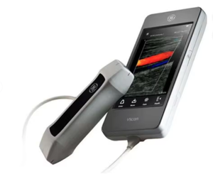 Escáner de Ultrasonido Portátil de Doble Sonda Vscan Extend R2 de Alto Rendimiento, a Color - Product Image 3