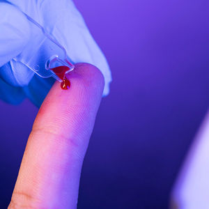 Microcuvette OptoHb non stérile, kit de classe II - Product Image 1