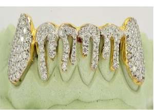 Joyería Dental de Lujo Personalizada para Regalo de Compromiso, Grillz de Plata de Ley 925 con Diamantes de Moissanita y Polvo de Diamante - Product Image 2