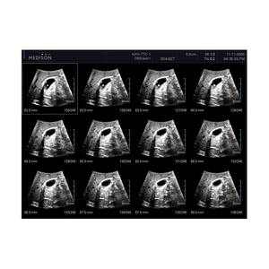 Máquina de Ultrasonido Samsung Accuvix V10 - Product Image 6