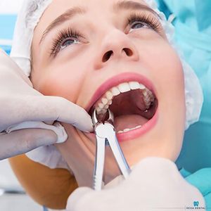 Eavy nhiệm vụ nha khoa chiết xuất <span class=keywords><strong>forceps</strong></span> #150 #151 #23, đỉnh kẹp, cowhorn kẹp, thấp hơn răng hàm, atraumair-3 cái - Product Image 3