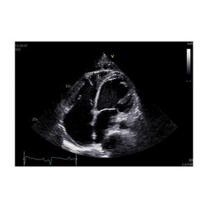 Appareil d'échographie GE Vivid E95 d'occasion - Product Image 4