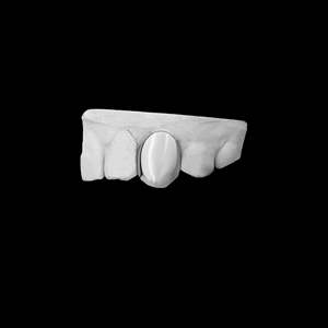 Rejilla Dental Personalizada Hecha a Mano CONCEPTION GRILLZ10, Cubierta Dental de Oro de 10K/14K para Dientes Superiores, Estilo Hip Hop para Hombre - Product Image 3