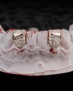 Grillz sur mesure de qualité supérieure, coupe ovale, en argent S925, plaqué or massif 10K 14K 18K, Moissanite VVS, sertis de pierres, pour les dents - Product Image 2