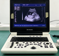Échographe vétérinaire portable, mode PW, appareil d'échographie numérique avec système d'imagerie