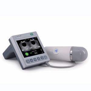 Harga pemindai kantung udara portabel/peralatan urologi tidak membatalkan retensi dan evaluasi Ultrasound diagnostik - Product Image 1