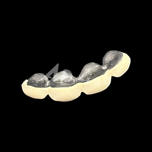 Pont <span class=keywords><strong>dentaire</strong></span> PFM : Conçu avec l'expertise <span class=keywords><strong>dentaire</strong></span>, conçu pour un confort durable - Product Image 1