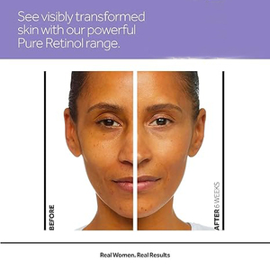 Crema Contorno de Ojos Personalizada con Ácido Hialurónico y Vitamina C para Ojeras, Reducción de Hinchazón, Revitalización de Ojos Cansados, para Todo Tipo de Piel - Product Image 5