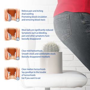 Krim Herbal Cina South Moon untuk Wasir, Fisura Ani, Gatal, Bengkak, Pereda Nyeri - Product Image 5