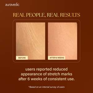 น้ำมันนวดกระชับสัดส่วน - Product Image 5