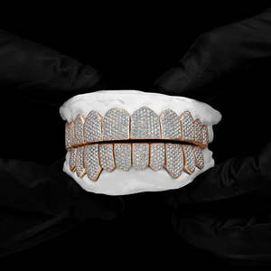 Grilles dentaires Hip Hop Iced Out, plaquées rhodium, bijoux Luxira, moissanite, argent 925, pour hommes - Product Image 1