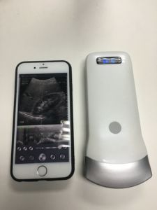 Sans fil android/ios réseau convexe usb sonde à ultrasons scanner à ultrasons ultrasons <span class=keywords><strong>de</strong></span> <span class=keywords><strong>poche</strong></span> à <span class=keywords><strong>prix</strong></span> <span class=keywords><strong>de</strong></span> vente - Product Image 3