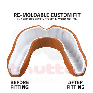 Protector Bucal de Goma Profesional Personalizable para Entrenamiento de Fútbol, Boxeo y Artes Marciales - Unisex con Forro de Mezcla de Algodón de 2 cm de Grosor - Product Image 4