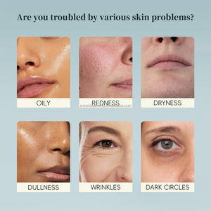 Kit perawatan kulit Korea Label pribadi, Set Perawatan Wajah kaca pemutih pelembap pencerah menghidrasi Exfoliator - Product Image 2