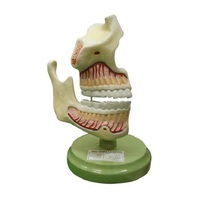 El modelo de mandíbula superior e inferior está agrandado, muestra la posición de los dientes y la mandíbula con sus raíces en el maxilar, 3 veces